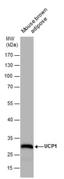 Anti-UCP1 antibody [GT3111] used in Western Blot (WB). GTX632185
